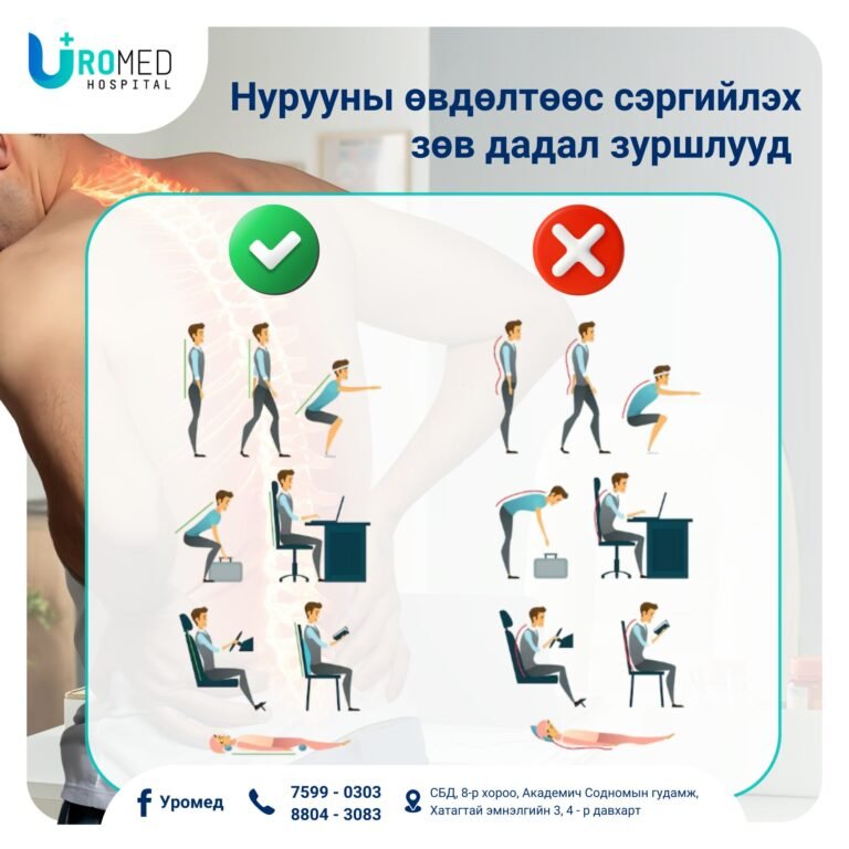 Нурууны өвдөлтөөс сэргийлэх зөв дадал зуршлууд